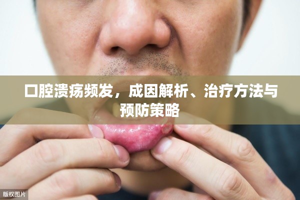 口腔溃疡频发,成因解析、治疗方法与预防策略
